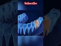 Dental#shorts #youtubeshorts #dentalclinic #teeth #molarity