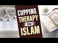 An extremely beneficial healing method  cupping therapy and islam  dawateisalmi english