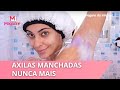 SAIBA COMO CLAREAR AS AXILAS MANCHADAS QUE INCOMODAM E CAUSAM CONSTRANGIMENTOS