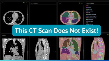 Generate Synthetic CT Images with AI: NVIDIA MAISI