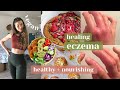 What I eat in a week ( Eczema Healing ) + plant based + grocery haul