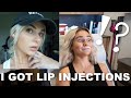 MY FIRST TIME GETTING LIPS INJECTIONS || EJB
