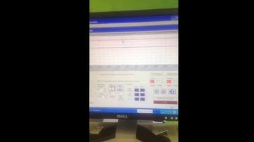 Hamstring rehab with Isokinetics Biodex System 3 - The SISM Clinic