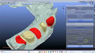 B4D Crown Module- Generating bridges