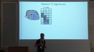 Tractography delineation of the vertical occipital fasciculus using quantitative T1 mapping