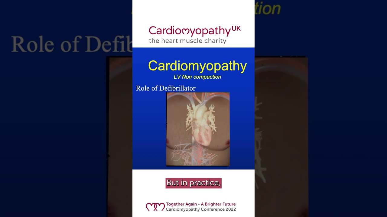 What does an ICD do?