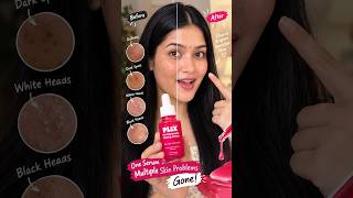 How Celebs Get Glass Skin In 10 Mins 😱 #CelebSkincare #GlowingSkin #SkincareRoutine #shorts