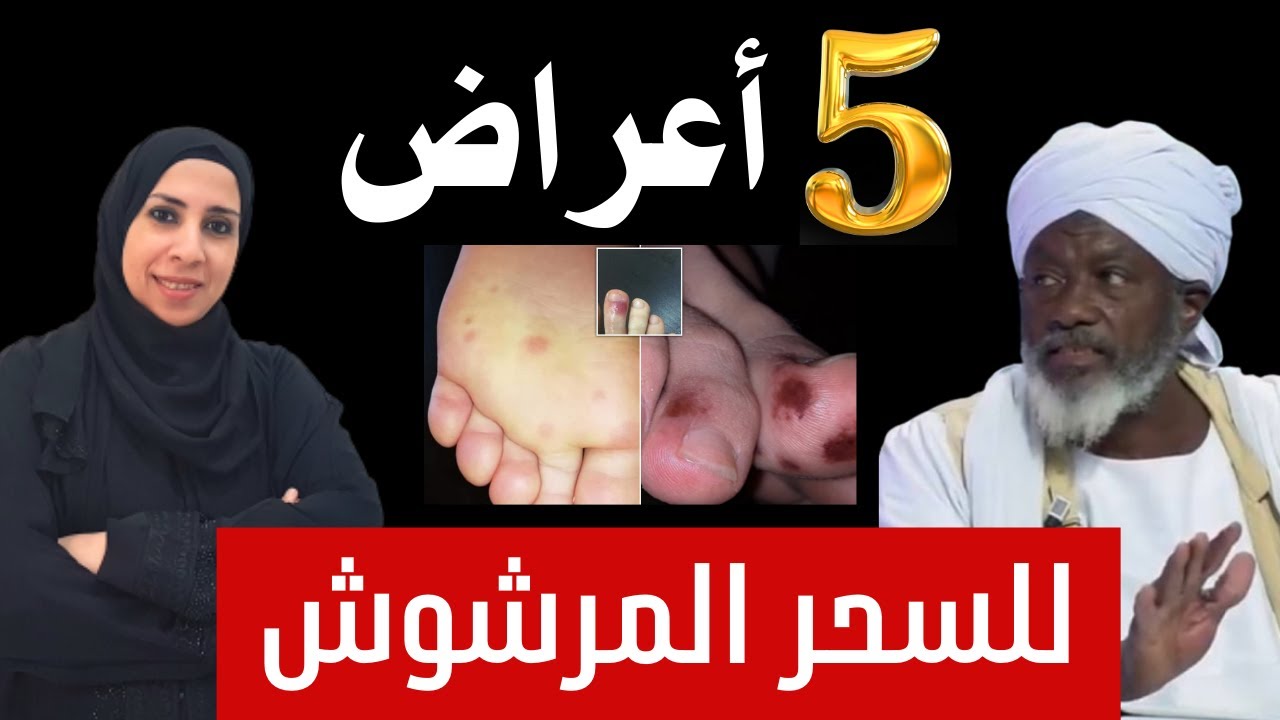 خمسة أعراض للسحر المرشوش تسمعها لأول مرة💥كيف تعرف من أحلامك أنك مسحور وما هى الاعراض المؤكدة للسحر‼️