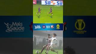 EMPATE NO FIM | GOLS | CAXIAS 1 X 1 ANÁPOLIS | SÉRIE C