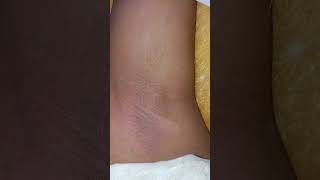 underarms waxing 😱#waxathome #shorts #shortvideo #shortfeed #viarl #youtubeshorts