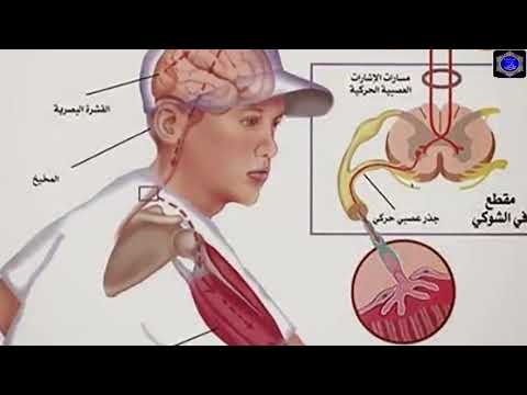 شاهد نهي النبي صلى الله عليه وسلم عن النفخ في الطعام أو الشراب الساخن