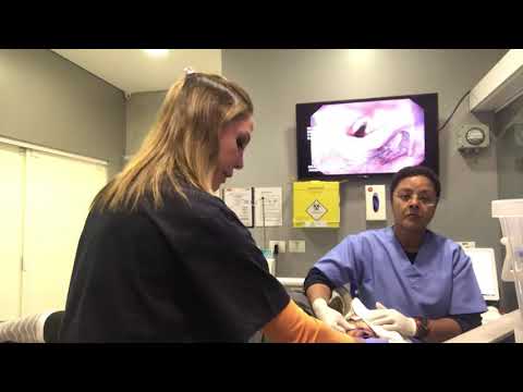 Vídeo: O que procura uma esofagogastroduodenoscopia?