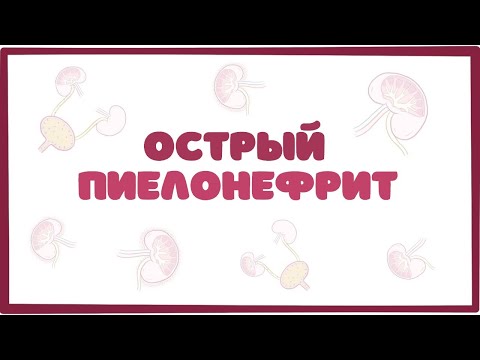 Острый пиелонефрит - причины, симптомы, терапия (лекция)