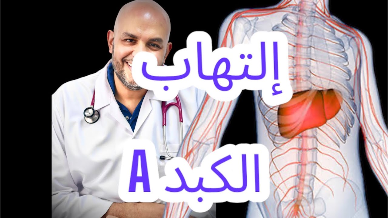 التهاب الكبد الوبائي أ / Hepatits A