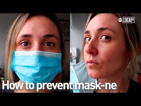 How to prevent 'mask-ne' AKA mask acne | Glam Lab