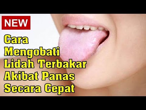 Video: Cara Makan Makanan Ringan semasa Fasa Induksi Diet Atkins