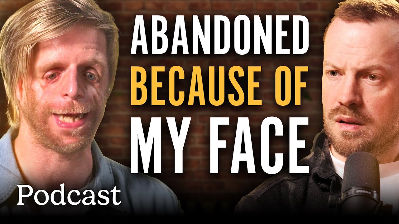 Abandoned At Birth And Bullied: How I Learnt To Love My Face | Minutes With Podcast | @LADbible TV