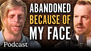 Abandoned At Birth And Bullied: How I Learnt To Love My Face | Minutes With Podcast | @LADbible