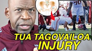 TUA TAGOVAILOA INURY (Hip Dislocation) Explained By Dr. Chris Raynor