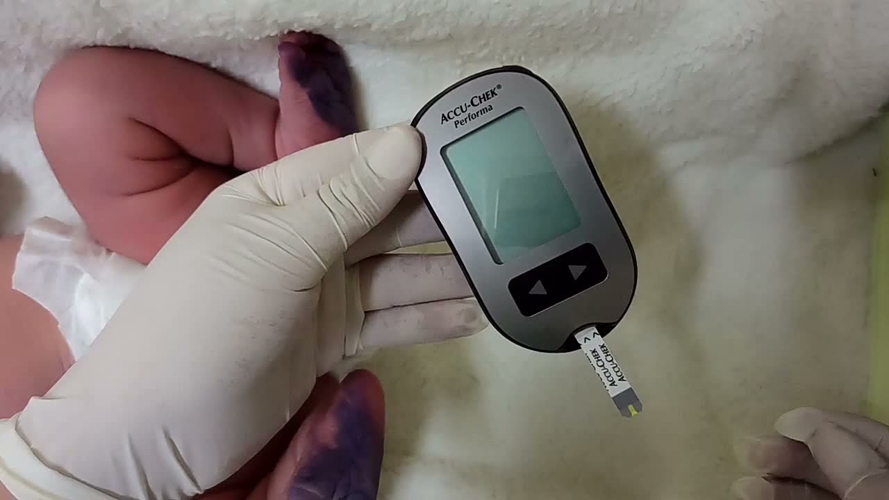 HEMOGLUCOTEST EN EL RECIEN NACIDO - YouTube