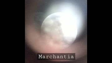 No edit : Marchantia thallus