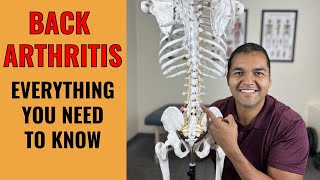 Back Arthritis: Everything You Need To Know To Understand And Fix The Root Problem