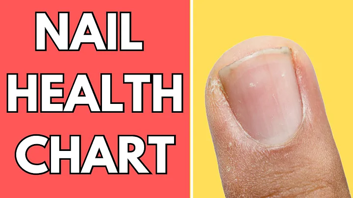 9 Health Warnings Signs Revealed by Looking at Your Nails