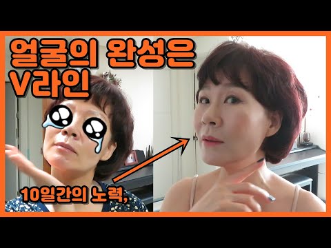 톡톡 튀는 스파클링 - 턱살저격! 브이라인 에센스 열흘 리얼후기!(feat.더유핏 브이라인 에센스  )