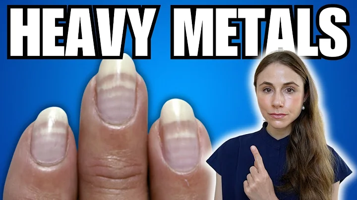 5 Warning Signs Of Heavy Metal Toxicity NOT TO MISS
