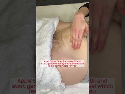 C-Section Scar Massage | My Expert Midwife