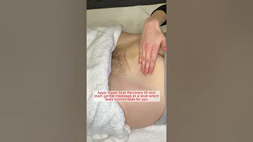 C-Section Scar Massage | My Expert Midwife
