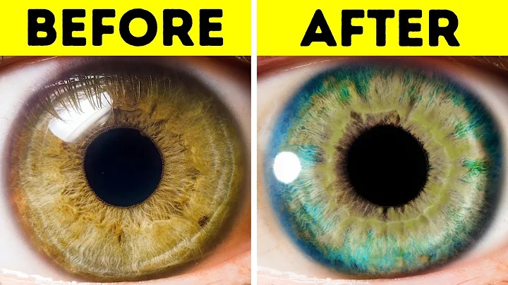 7 Things That Can Change Your Eye Color - DayDayNews