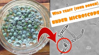 Wild yeast under microscope