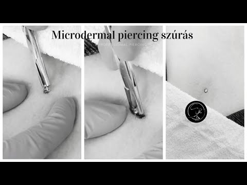 Microdermal piercing szúrás - Százszorszép kozmetika Szombathely - YouTube
