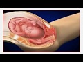 Proses Perjalanan Sperma ke Dalam Mulut Rahim