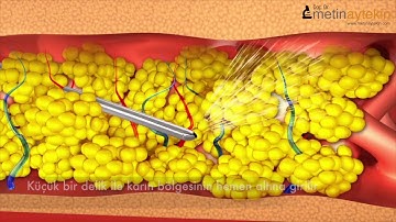 What we do. Ne yaptığımızı anlatan kısa video