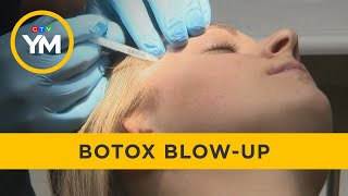Botox blow-up: Why gen-z loves injectables | Your Morning