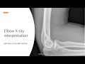 Elbow xray interpretationexamination abcs method