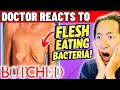 Plastic Surgeon Reacts to BOTCHED: Breasts + Flesh Eating Bacteria!