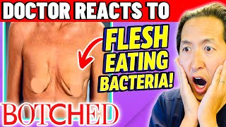 Plastic Surgeon Reacts to BOTCHED: Breasts + Flesh Eating Bacteria!