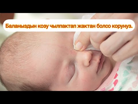 Video: Баламдын көзү кысып калдыбы?