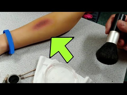How to create a fake bruise