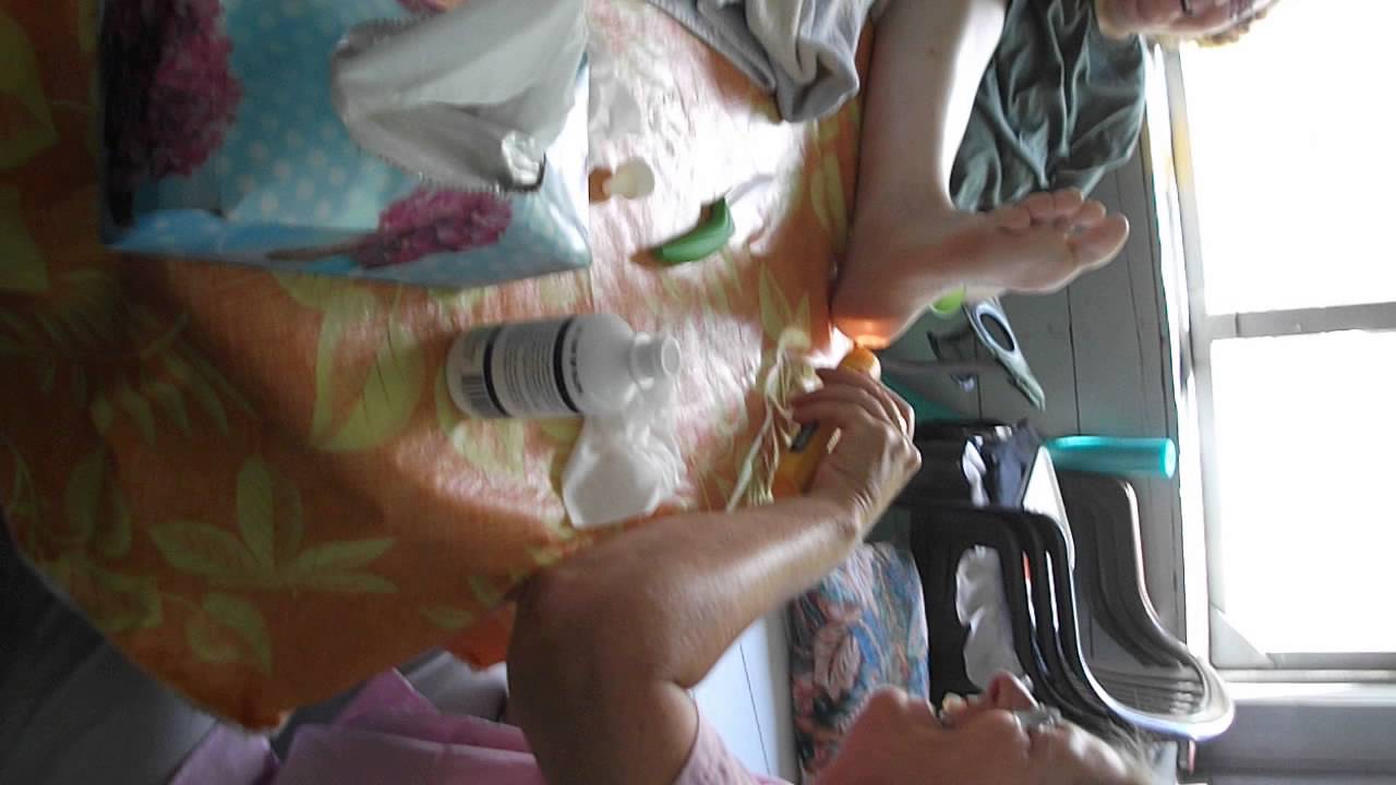 Major surgery at the cottage.... ;) - YouTube