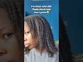 Ayurvedic Treatment for hair growth. #naturalhair #hairgrowth #treatment