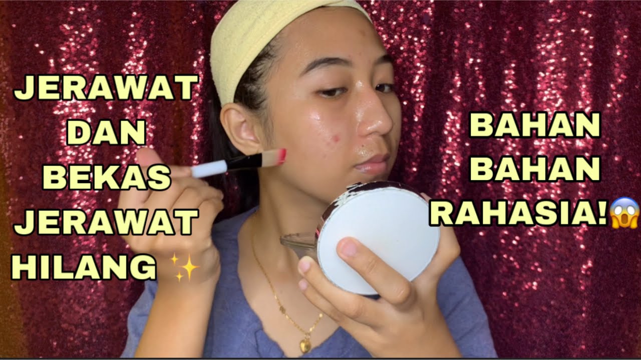 CARA AMPUH MENGHILANGKAN JERAWAT DAN BEKAS JERAWAT DENGAN INI | Bahan