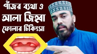 Ala zihba fular Hadither treatment | Pazor bethar Haditer treatment | Hafez Helal Uddin