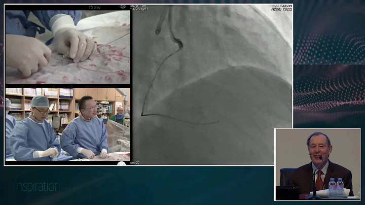 [CTO LIVE 2016] Live Case Session II