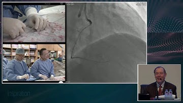 [CTO LIVE 2016] Live Case Session II