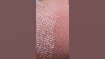 Skin Peeling Macro Closeup – Relaxing ASMR #asmr