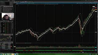 OPTIONS TRADING MORNING PREP W/FOCUSED TRADES: Daily Squeezes!